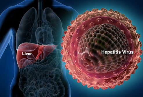 What You Need To Know About Hepatitis A