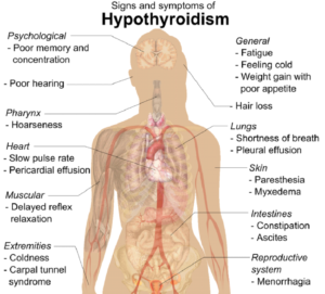 hypothyroidism