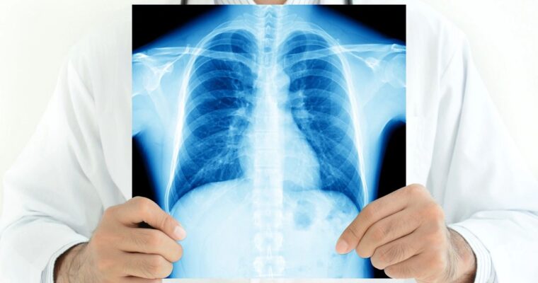 What is Asthma? (Part 2)
