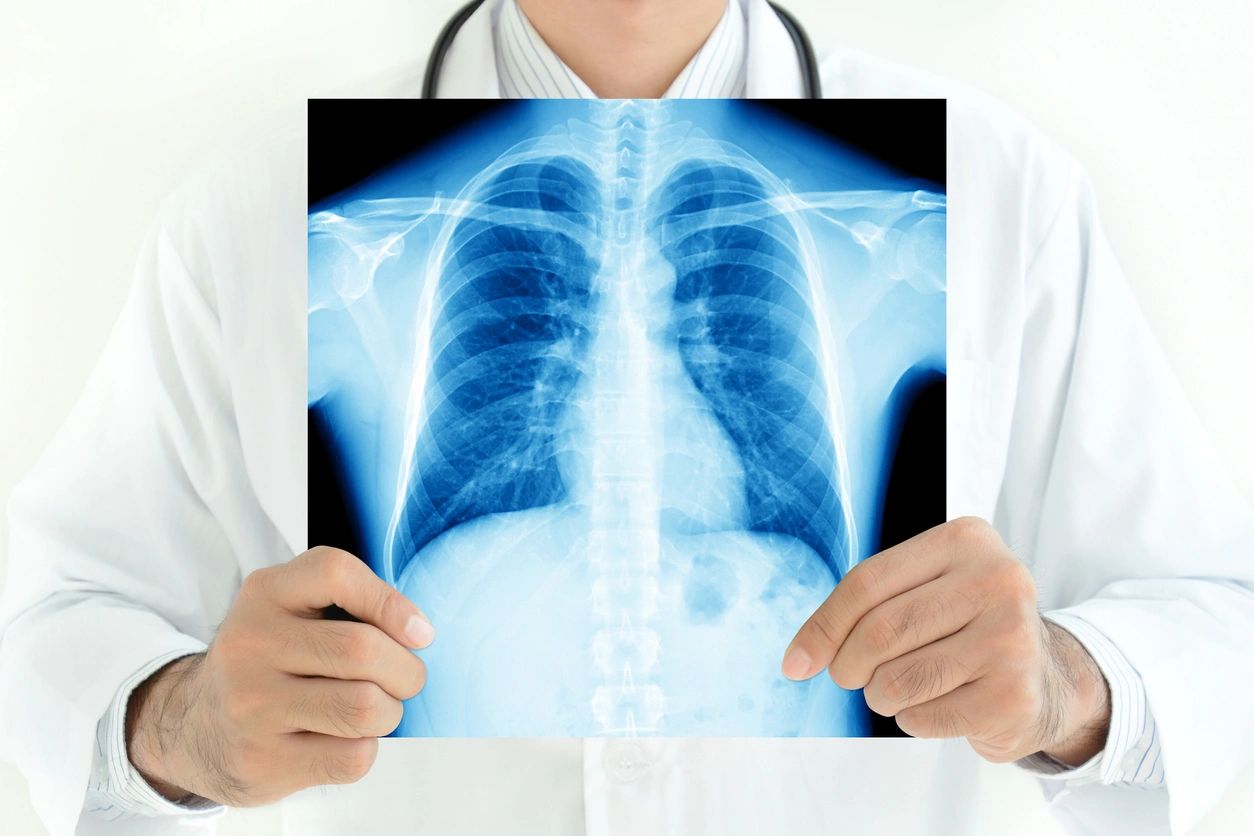 What is Asthma? (Part 2)